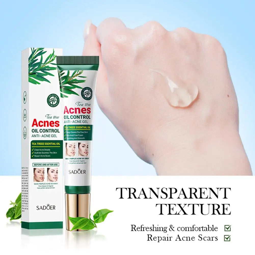 Crème Anti-Acné à l'Arbre à Thé SADOER – Contrôle du Sébum & Soin Purifiant