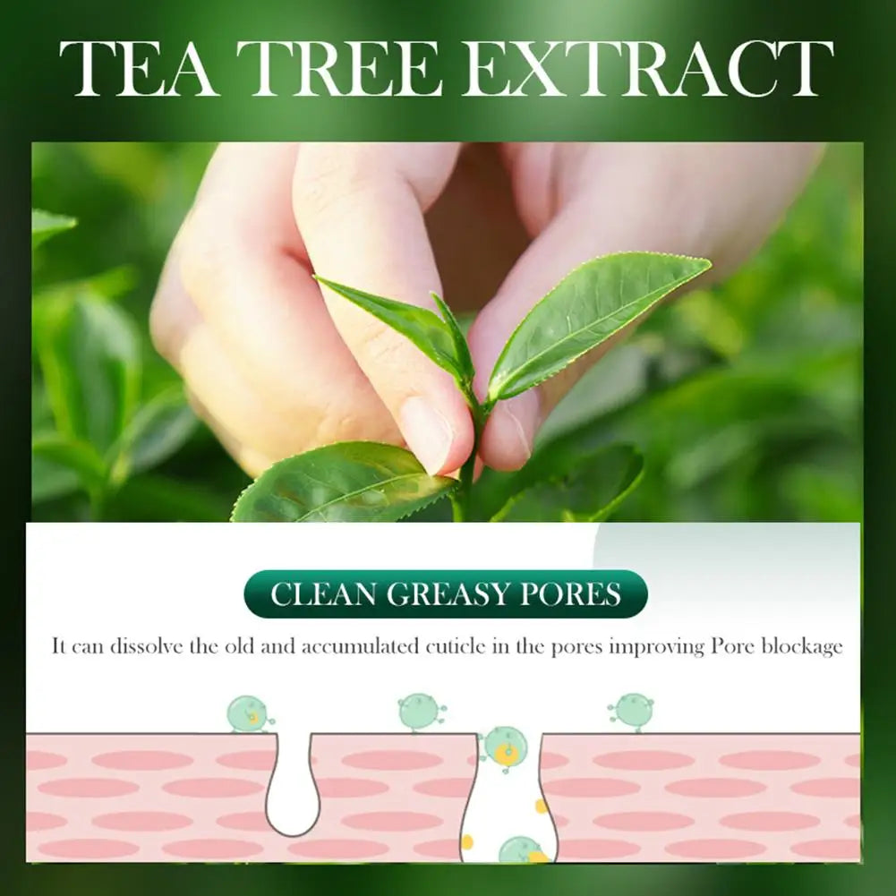 Crème Anti-Acné à l'Arbre à Thé SADOER – Contrôle du Sébum & Soin Purifiant