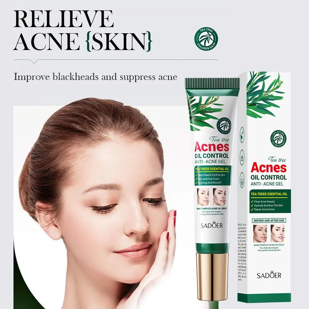 Crème Anti-Acné à l'Arbre à Thé SADOER – Contrôle du Sébum & Soin Purifiant